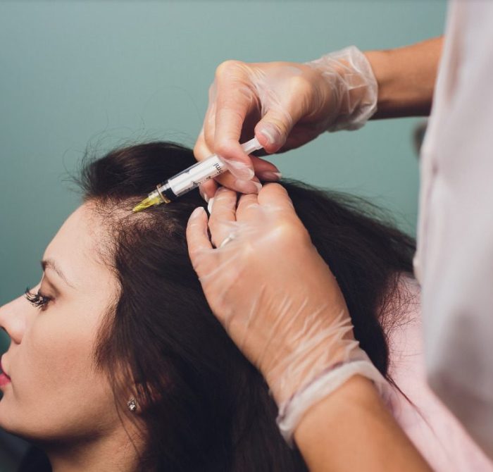 PRP for hair loss in women at Lotus Health & Aesthetics